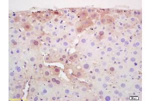 Formalin-fixed and paraffin embedded mouse liver labeled with Rabbit Anti CPT2 Polyclonal Antibody, Unconjugated (ABIN708881) at 1:200 followed by conjugation to the secondary antibody and DAB staining (CPT2 anticorps  (AA 401-500))