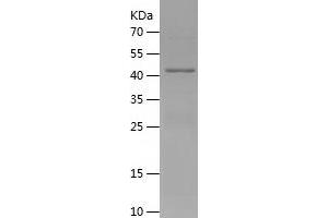 Western Blotting (WB) image for Perilipin 2 (PLIN2) (AA 82-311) protein (His-IF2DI Tag) (ABIN7124355)