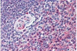 Human Spleen (formalin-fixed, paraffin-embedded) stained with CD97 antibody ABIN292888 at 10 ug/ml followed by biotinylated goat anti-rabbit IgG secondary antibody ABIN481713, alkaline phosphatase-streptavidin and chromogen. (CD97 anticorps  (AA 220-270))