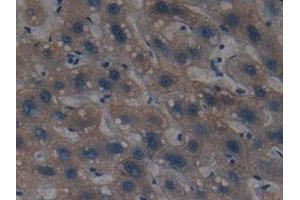Detection of CK4 in Human Liver Tissue using Polyclonal Antibody to Cytokeratin 4 (CK4) (KRT4 anticorps  (AA 152-457))