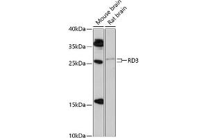 Western blot analysis of extracts of various cell lines, using RD3 antibody (ABIN6133326, ABIN6146834, ABIN6146835 and ABIN6217059) at 1:1000 dilution. (RD3 anticorps  (AA 1-195))