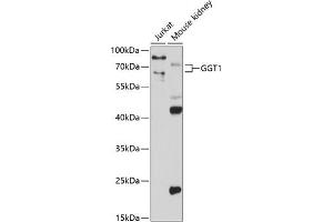 Western blot analysis of extracts of various cell lines, using GGT1 antibody (ABIN3022526, ABIN3022527, ABIN3022528 and ABIN6218881) at 1:1000 dilution.
