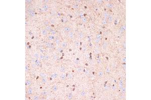 Immunohistochemistry of paraffin-embedded mouse brain using Gelsolin Rabbit mAb (ABIN7267364) at dilution of 1:100 (40x lens). (Gelsolin anticorps)