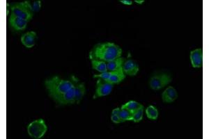 Immunofluorescence staining of MCF-7 cells with ABIN7153155 at 1:133, counter-stained with DAPI. (FREM2 anticorps  (AA 1986-2127))