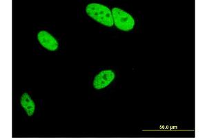 Immunofluorescence of monoclonal antibody to MED9 on HeLa cell. (MED9 anticorps  (AA 1-146))