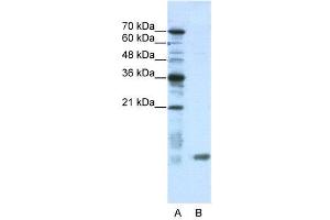 WB Suggested Anti-C14ORF156  Antibody Titration: 0.
