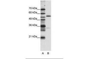 Image no. 1 for anti-Zinc Finger Protein 655 (ZNF655) (N-Term) antibody (ABIN203180) (ZNF655 anticorps  (N-Term))