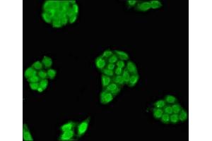 Immunofluorescent analysis of PC-3 cells using ABIN7159078 at dilution of 1:100 and Alexa Fluor 488-congugated AffiniPure Goat Anti-Rabbit IgG(H+L) (MXI1 anticorps  (AA 75-173))
