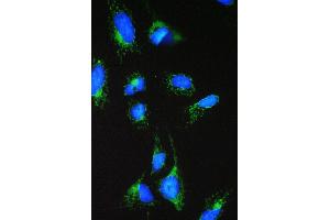 IF analysis of ACAA2 using anti-ACAA2 antibody (ABIN4886414). (ACAA2 anticorps  (Middle Region))