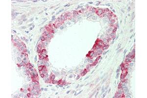Anti-O3FAR1 / GPR120 antibody IHC staining of human prostate.