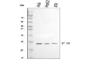 Western blot analysis of ND6/MT-ND6 using anti-ND6/MT-ND6 antibody (ABIN7599589). (MT-ND6 anticorps  (AA 10-174))