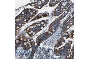 Immunohistochemical staining of human colon with WSCD2 polyclonal antibody  shows strong cytoplasmic positivity, with a granular pattern, in glandular cells. (WSCD2 anticorps)