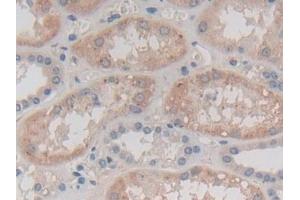 Detection of CAPN3 in Human Kidney Tissue using Polyclonal Antibody to Calpain 3 (CAPN3) (Calpain 3 anticorps  (AA 602-821))