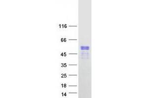 Validation with Western Blot