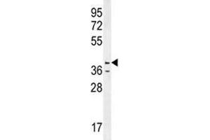 Caspase-12 antibody western blot analysis in HL-60 lysate