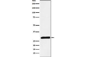 Western blot analysis of PRSS2 expression in Human pancreas lysate.
