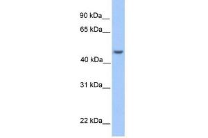 ASB6 antibody used at 1 ug/ml to detect target protein. (ASB6 anticorps  (Middle Region))