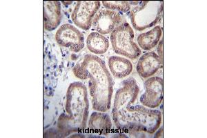S Antibody (Center) (ABIN656799 and ABIN2846017) immunohistochemistry analysis in formalin fixed and paraffin embedded human kidney tissue followed by peroxidase conjugation of the secondary antibody and DAB staining. (SP140 anticorps  (AA 272-301))