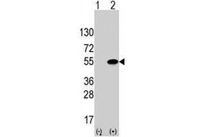 Western blot analysis of ATF4 (arrow) using rabbit ATF4 polyclonal antibody . (ATF4 anticorps  (Ser245))