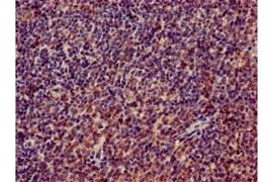 Immunohistochemistry of paraffin-embedded human lymph node tissue using ABIN7142825 at dilution of 1:100 (RPL4 anticorps  (AA 12-91))