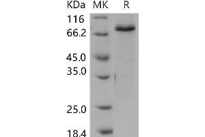 Western Blotting (WB) image for SMAD, Mothers Against DPP Homolog 3 (SMAD3) protein (GST tag,His tag) (ABIN7320082)