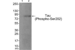 Western blot analysis of extracts from JK cells (Lane 2), using Tau (Phospho-Ser202) Antibody. (MAPT anticorps  (pSer202))