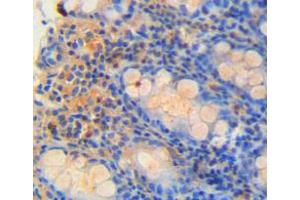 Used in DAB staining on fromalin fixed paraffin-embedded rectum tissue (REG4 anticorps  (AA 45-151))