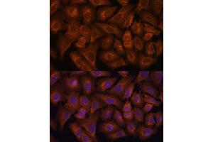Immunofluorescence analysis of U-2 OS cells using NEXN antibody (ABIN6132932, ABIN6144546, ABIN6144547 and ABIN6217017) at dilution of 1:100.