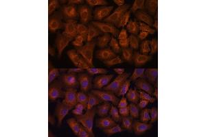 Immunofluorescence analysis of U-2 OS cells using NEXN antibody (ABIN6132932, ABIN6144546, ABIN6144547 and ABIN6217017) at dilution of 1:100. (NEXN anticorps  (AA 516-675))