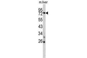 Western blot analysis of TNFAIP2 antibody (Center) in mouse liver lysates (35ug/lane).