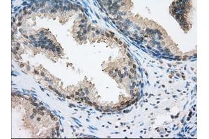 Immunohistochemical staining of paraffin-embedded pancreas tissue using anti-ERCC1 mouse monoclonal antibody. (ERCC1 anticorps)