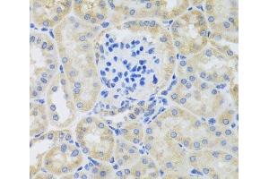 Immunohistochemistry of paraffin-embedded Mouse kidney using BNIP3 Polyclonal Antibody at dilution of 1:100 (40x lens).