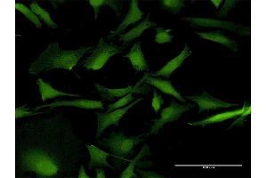 Immunofluorescence of purified MaxPab antibody to RAB31 on HeLa cell.