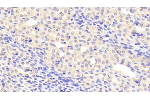 Detection of C1INH in Mouse Kidney Tissue using Polyclonal Antibody to Complement 1 Inhibitor (C1INH)