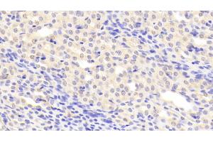 Detection of C1INH in Mouse Kidney Tissue using Polyclonal Antibody to Complement 1 Inhibitor (C1INH) (SERPING1 anticorps  (AA 35-179))