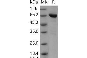 Western Blotting (WB) image for TEK Tyrosine Kinase, Endothelial (TEK) (AA 770-1122) (Active) protein (GST tag,His tag) (ABIN7320054)