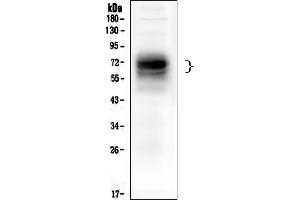 Western blot analysis of CD46 using anti ZO-1 antibody (ABIN7602758).