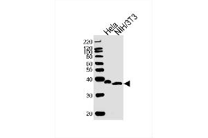 Lane 1: Hela Cell lysates, Lane 2: NIH/3T3 Cell lysates, probed with NFKBIA (1121CT8. (NFKBIA anticorps)