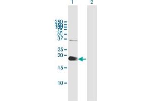 Western Blot analysis of ZCCHC13 expression in transfected 293T cell line by ZCCHC13 MaxPab polyclonal antibody. (ZCCHC13 anticorps  (AA 1-166))