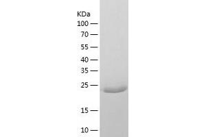 Western Blotting (WB) image for 3-Ketodihydrosphingosine Reductase (KDSR) (AA 26-270) protein (His-IF2DI Tag) (ABIN7121613)