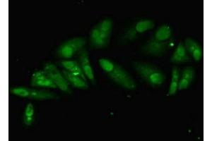Immunofluorescent analysis of Hela cells using ABIN7155120 at dilution of 1:100 and Alexa Fluor 488-congugated AffiniPure Goat Anti-Rabbit IgG(H+L)