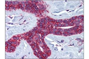 Human Breast: Formalin-Fixed, Paraffin-Embedded (FFPE)