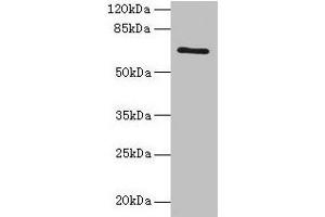 Western blot All lanes: HEATR9 antibody at 1. (C17orf66 anticorps  (AA 1-219))