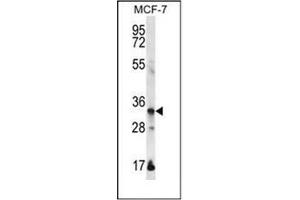 Western blot analysis of EVPLL Antibody (Center) in MCF-7 cell line lysates (35ug/lane). (Envoplakin-Like anticorps  (Middle Region))