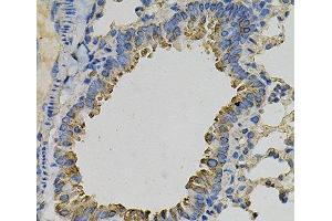 Immunohistochemistry of paraffin-embedded Mouse lung using PSAT1 Polyclonal Antibody at dilution of 1:100 (40x lens). (PSAT1 anticorps)