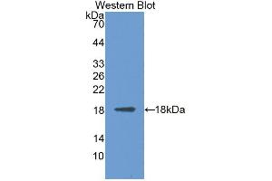 Western blot analysis of the recombinant protein. (MAN2B1 anticorps  (AA 883-1011))