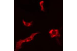 ABIN6266975 staining LOVO cells by IF/ICC. (ATPBD3 anticorps  (C-Term))