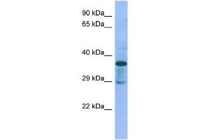 Host:  Rabbit  Target Name:  C1galt1c1  Sample Type:  Rat pancreas lysates  Antibody Dilution:  1. (C1GALT1C1 anticorps  (N-Term))