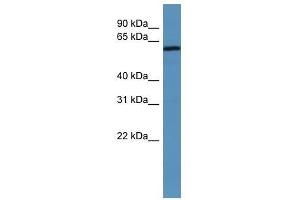 MAGED2 antibody used at 0. (MAGED2 anticorps  (N-Term))