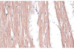 Immunohistochemistry of paraffin-embedded Rat heart using COL11A1 Polyclonal Antibody at dilution of 1:100 (40x lens). (COL11A1 anticorps)
